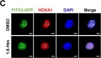 Fig.5.C showing Immunocytochemistry-immunofluorescence in a Homo sapiens (Human) sample from the publication: Nortriptyline Inhibits Lysosomal Exocytosis-Mediated SASP During Gastric Cancer Progression via Targeting HOXA1-PITX2 Phase Separation.