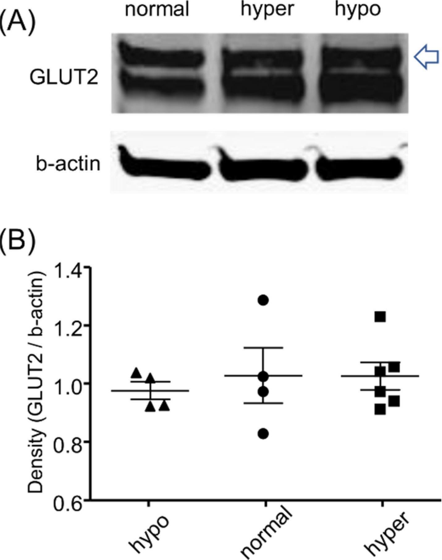 Fig.6.A showing Western Blotting from the publication: Luseogliflozin, a SGLT2 Inhibitor, Does Not Affect Glucose Uptake Kinetics in Renal Proximal Tubules of Live Mice.