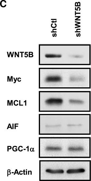 Fig.6.C showing Western Blotting in a Homo sapiens (Human) sample from the publication: Wnt modulates MCL1 to control cell survival in triple negative breast cancer.