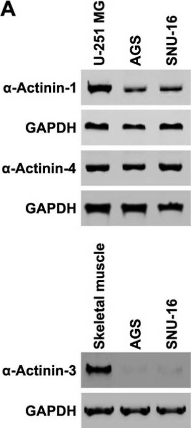Fig.4.A showing Western Blotting in a Mus musculus (House mouse) sample from the publication: Induction of filopodia formation by α-Actinin-2 via RelA with a feedforward activation loop promoting overt bone marrow metastasis of gastric cancer.