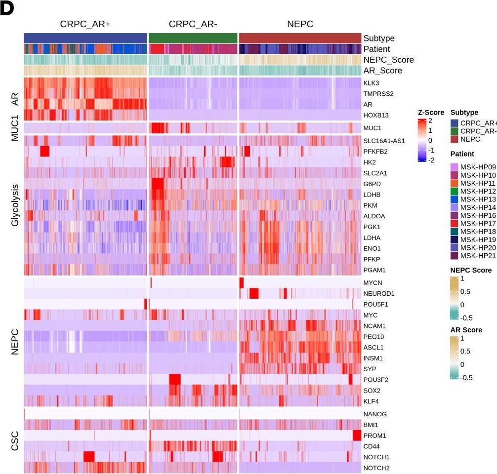Fig.8.D showing Immunohistochemistry in a Homo sapiens (Human) sample from the publication: MUC1-C dependence in treatment-resistant prostate cancer uncovers a target for antibody-drug conjugate therapy.