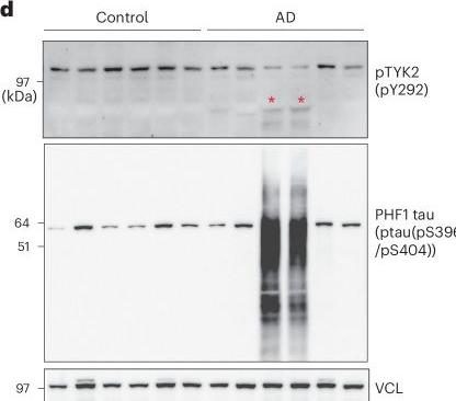 Fig.4.D showing Western Blotting from the publication: TYK2 regulates tau levels, phosphorylation and aggregation in a tauopathy mouse model.
