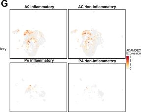 Fig.4.G showing Flow cytometry/Cell sorting from the publication: Urinary Proteomics Identifies ADAMDEC1 as a Non-invasive Biomarker of Unstable Carotid Atherosclerotic Plaques.