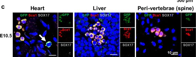 Fig.4.C showing Immunohistochemistry-immunofluorescence in a Mus musculus (House mouse) sample from the publication: SOX17-mediated LPAR4 expression plays a pivotal role in cardiac development and regeneration after myocardial infarction.