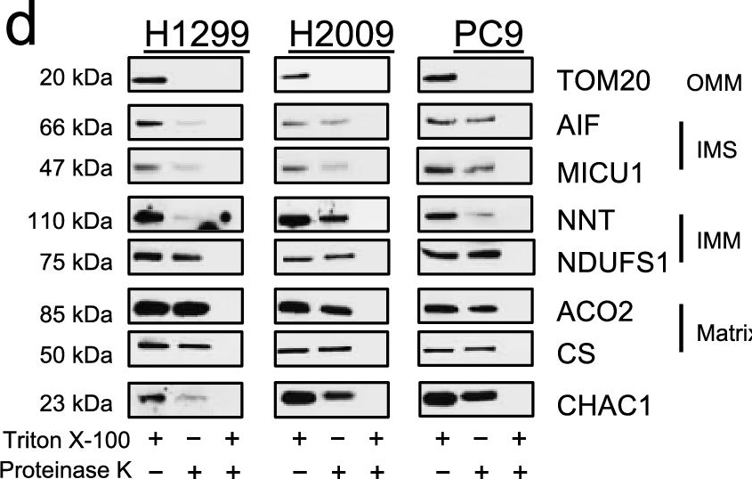 Fig.4.D showing Western Blotting from the publication: Mitochondrial respiratory function is preserved under cysteine starvation via glutathione catabolism in NSCLC.
