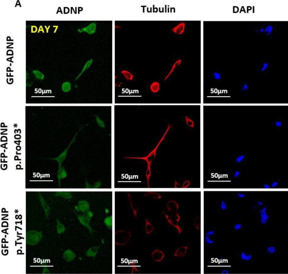 Fig.4.A showing Immunocytochemistry-immunofluorescence from the publication: Distinct Impairments Characterizing Different ADNP Mutants Reveal Aberrant Cytoplasmic-Nuclear Crosstalk.