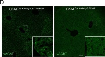 Fig.2.D showing Immunohistochemistry-immunofluorescence in a Mus musculus (House mouse) sample from the publication: The development of hepatic steatosis depends on the presence of liver-innervating parasympathetic cholinergic neurons in mice fed a high-fat diet.