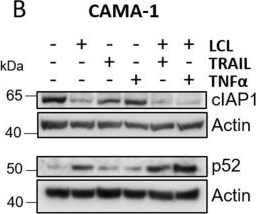 Fig.2.B showing Western Blotting in a Homo sapiens (Human) sample from the publication: Induction of Breast Cancer Cell Apoptosis by TRAIL and Smac Mimetics: Involvement of RIP1 and cFLIP.