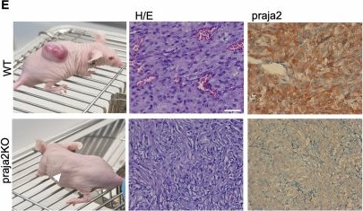 Fig.8.E showing Immunohistochemistry from the publication: Praja2 controls P-body assembly and translation in glioblastoma by non-proteolytic ubiquitylation of DDX6.