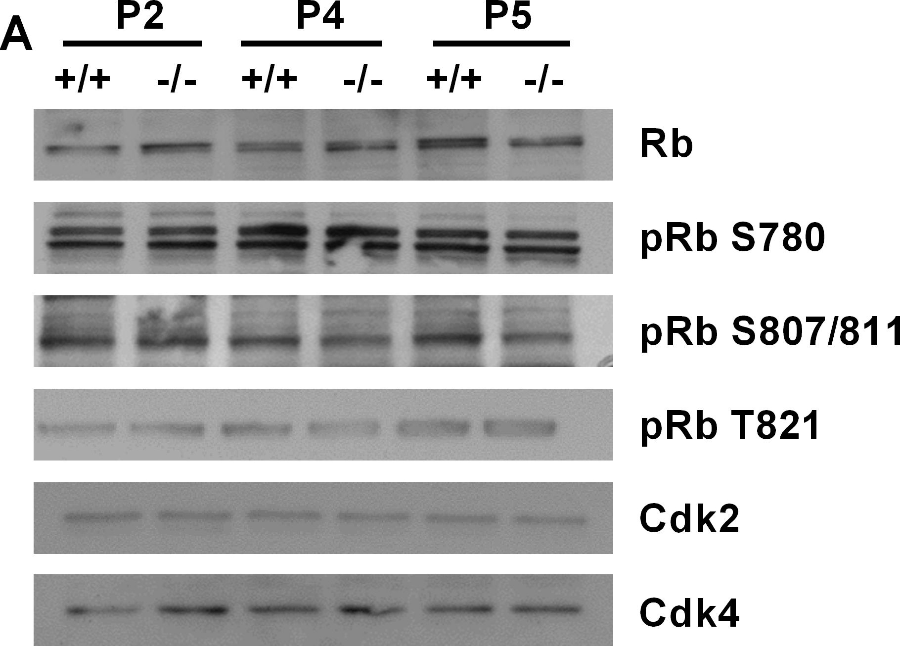 Fig.6.A showing Western Blotting in a Mus musculus (House mouse) sample from the publication: Poldip2 knockout results in perinatal lethality, reduced cellular growth and increased autophagy of mouse embryonic fibroblasts.