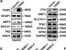 Fig.4.A showing Western Blotting from the publication: TCF3 activates super-enhancer-driven TRIB2 overexpression to suppress ferroptosis and promote hepatoblastoma proliferation.