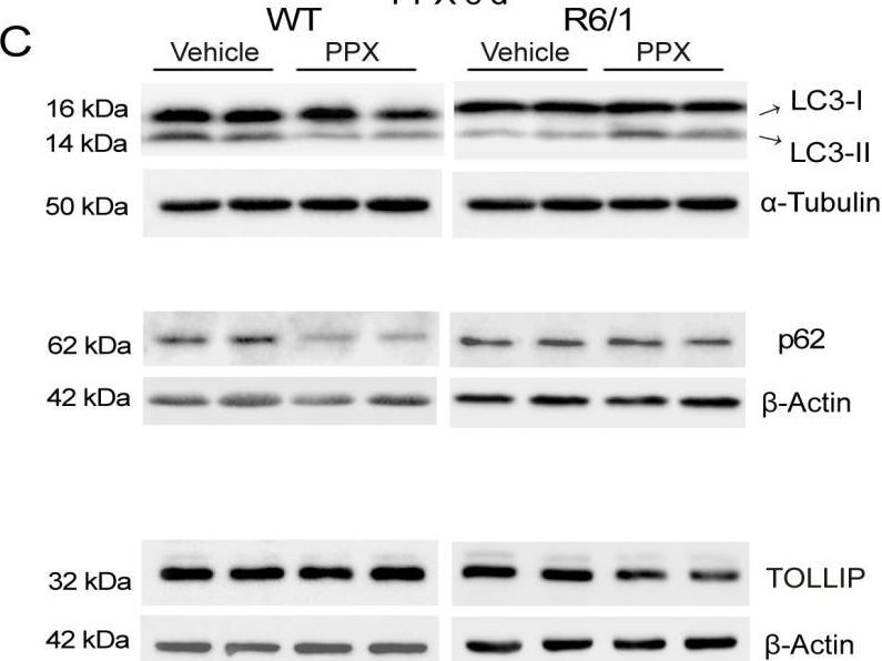 Dopamine Receptor D3 Induces Transient, mTORC1-Dependent Autophagy That Becomes Persistent, AMPK-Mediated, and Neuroprotective in Experimental Models of Huntington's Disease.