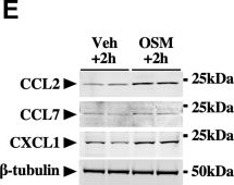 Fig.6.E showing Western Blotting from the publication: Essential roles of the cytokine oncostatin M in crosstalk between muscle fibers and immune cells in skeletal muscle after aerobic exercise.