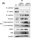 Fig.3.E showing Western Blotting from the publication: ARID1A-deficient cells require HDAC6 for progression of endometrial carcinoma.