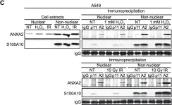 Fig.4.C showing Western Blotting in a Homo sapiens (Human) sample from the publication: Genotoxic agents promote the nuclear accumulation of annexin A2: role of annexin A2 in mitigating DNA damage.