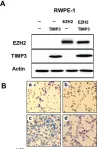 Fig.8.A showing Western Blotting from the publication: The role of EZH2 in the regulation of the activity of matrix metalloproteinases in prostate cancer cells.