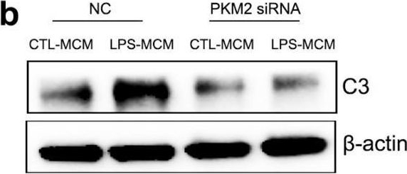 Fig.5.B showing Western Blotting in a Mus musculus (House mouse) sample from the publication: Microglia PKM2 Mediates Neuroinflammation and Neuron Loss in Mice Epilepsy through the Astrocyte C3-Neuron C3R Signaling Pathway.