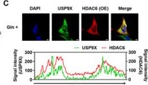 Fig.3.C showing Immunocytochemistry-immunofluorescence in a Homo sapiens (Human) sample from the publication: HDAC6 and USP9X Control Glutamine Metabolism by Stabilizing GS to Promote Glioblastoma Tumorigenesis.