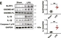 IL-18 (E3G8R) Rabbit Monoclonal Antibody | Cell Signaling Technology