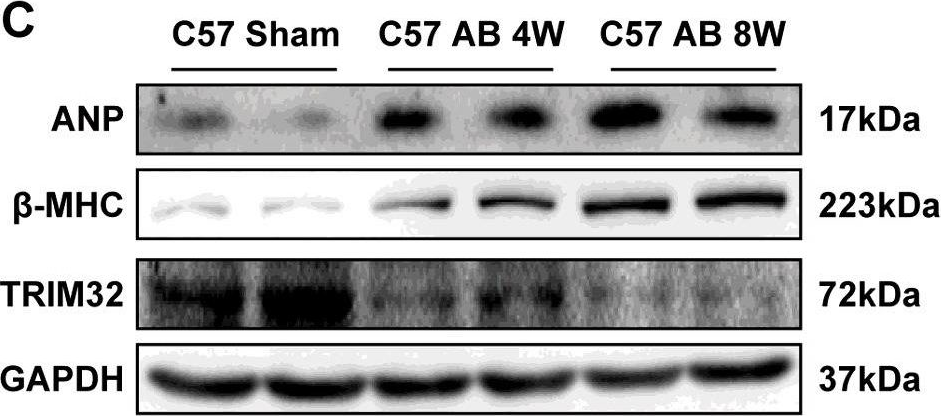 Fig.1.C showing Western Blotting in a Mus musculus (House mouse) sample from the publication: Tripartite motif 32 prevents pathological cardiac hypertrophy.