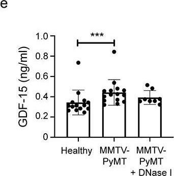 Fig.3.E showing Enzyme-linked immunosorbent assay in a Mus musculus (House mouse) sample from the publication: Neutrophil extracellular traps promote cancer-associated inflammation and myocardial stress.