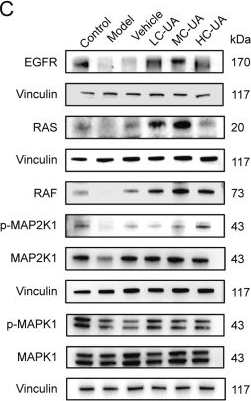 Fig.9.C showing Western Blotting from the publication: Ursolic acid ameliorates ocular surface dysfunction in dry eye via targeting EGFR/RAS/RAF/MAP2K1/MAPK1 pathway.