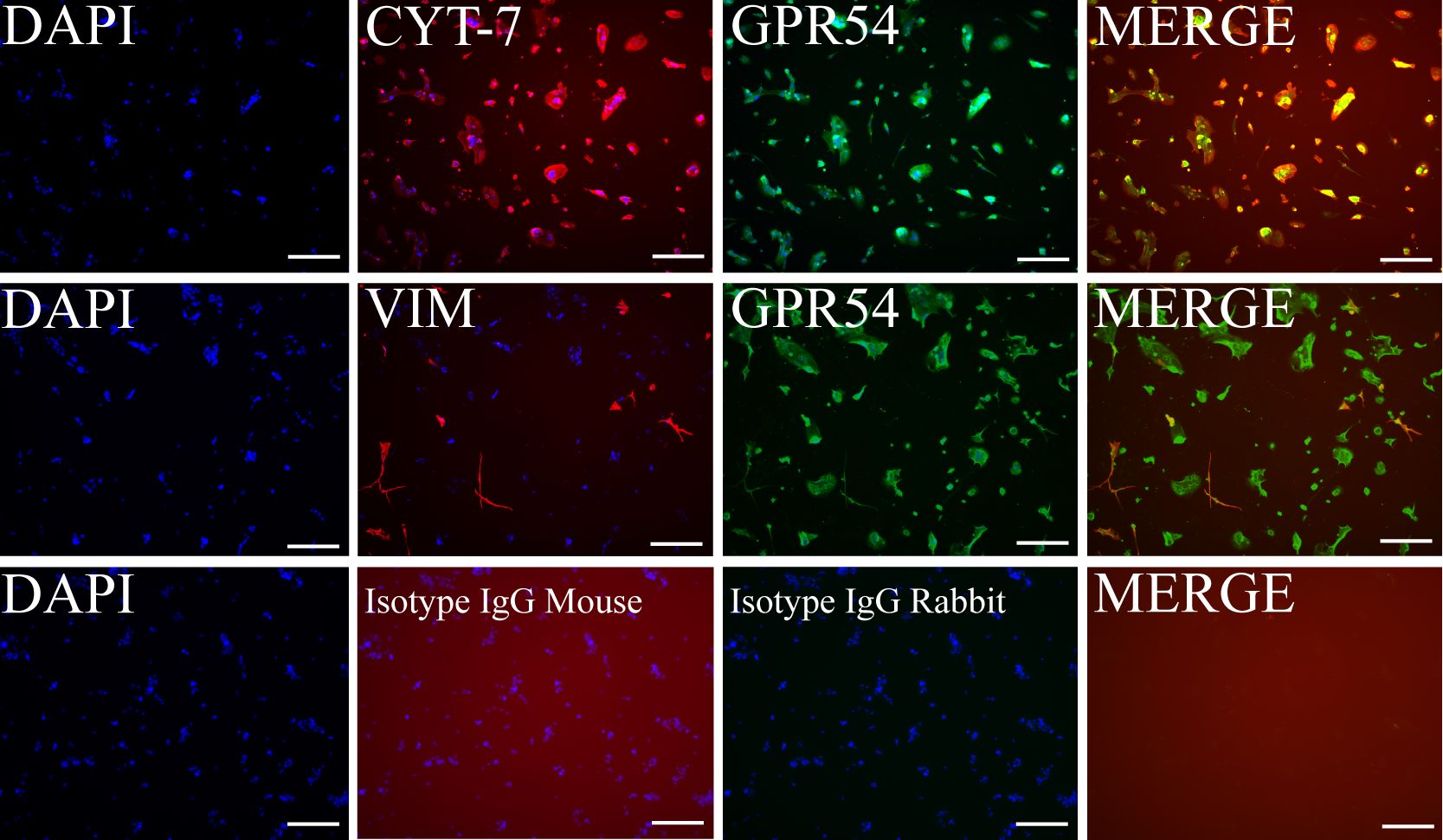 Fig.1.A showing Immunocytochemistry-immunofluorescence in a Homo sapiens (Human) sample from the publication: Kisspeptin regulation of genes involved in cell invasion and angiogenesis in first trimester human trophoblast cells.