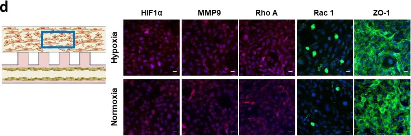 Fig.3.D showing Immunohistochemistry-immunofluorescence in a Homo sapiens (Human) sample from the publication: A Microphysiological Model to Mimic the Placental Remodeling during Early Stage of Pregnancy under Hypoxia-Induced Trophoblast Invasion.