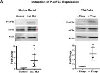 ペッレモルビダ Phospho-Histone H2A.X (Ser139) (20E3) Rabbit mAb (Alexa