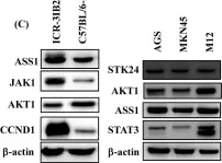 Fig.2.C showing Western Blotting from the publication: Knockdown of serine/threonine-protein kinase 24 promotes tumorigenesis and myeloid-derived suppressor cell expansion in an orthotopic immunocompetent gastric cancer animal model.
