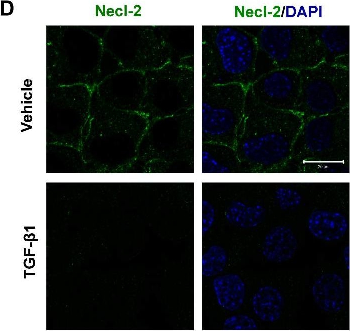Fig.1.D showing Immunocytochemistry-immunofluorescence in a Mus musculus (House mouse) sample from the publication: Transforming growth factor-β1 (TGF-β1) regulates cell junction restructuring via Smad-mediated repression and clathrin-mediated endocytosis of nectin-like molecule 2 (Necl-2).