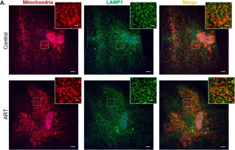 Fig.6.A showing Immunocytochemistry-immunofluorescence from the publication: Antiretroviral Drugs Impact Autophagy Differently in Primary Human Astrocytes.
