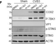 Phospho-STING (Ser366) (D7C3S) Rabbit mAb | Cell Signaling