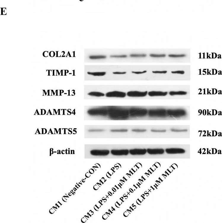 Fig.4.E showing Western Blotting from the publication: Medical Prospect of Melatonin in the Intervertebral Disc Degeneration through Inhibiting M1-Type Macrophage Polarization via SIRT1/Notch Signaling Pathway.