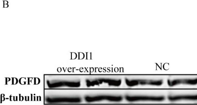 Fig.6.B showing Western Blotting from the publication: The Effects of DDI1 on Inducing Differentiation in Ovine Preadipocytes via Oar-miR-432.
