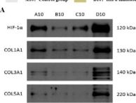 Anti HIF-1 Alpha Antibody (D1S7W) Rabbit mAb | Cell