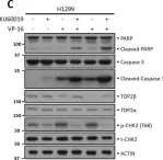 Fig.6.C showing Western Blotting in a Homo sapiens (Human) sample from the publication: ATM inhibitor KU60019 synergistically sensitizes lung cancer cells to topoisomerase II poisons by multiple mechanisms.