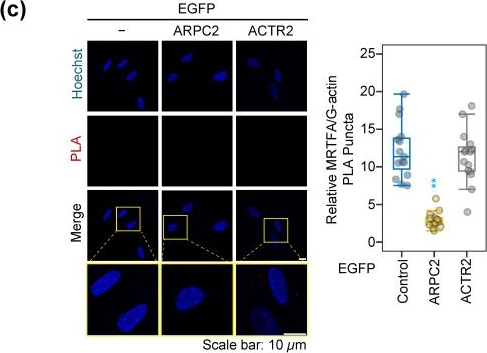 Fig.4.C showing Immunocytochemistry-immunofluorescence in a Homo sapiens (Human) sample from the publication: ARPC2 Promotes Pulmonary Fibrosis by Regulating MRTFA Activity Independent of the Canonical ARP2/3 Complex.