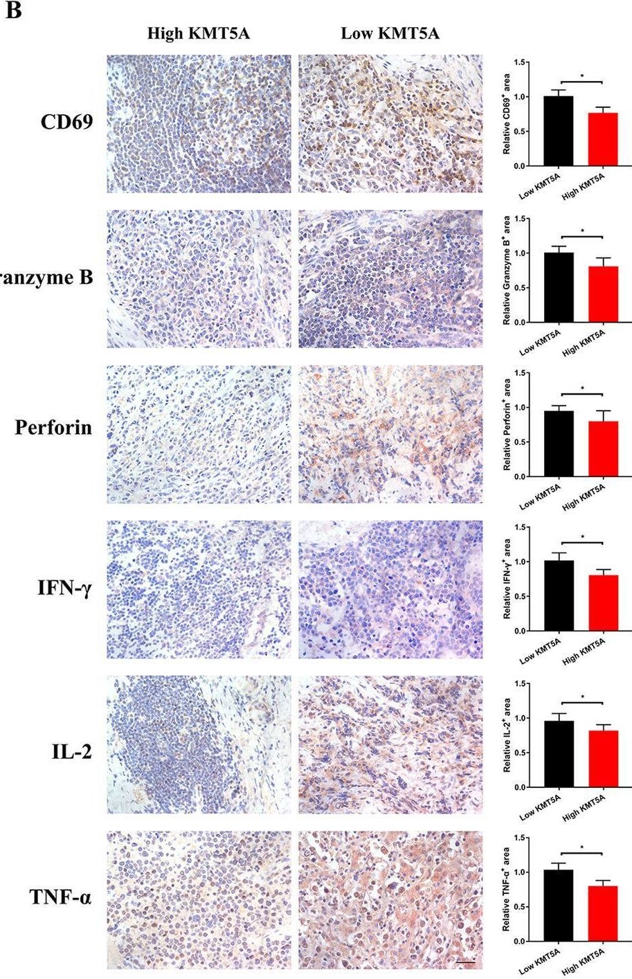 Fig.5.B showing Immunohistochemistry from the publication: MiRNA-340-5p mediates the functional and infiltrative promotion of tumor-infiltrating CD8+ T lymphocytes in human diffuse large B cell lymphoma.