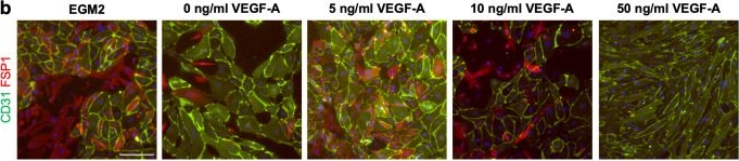 Fig.4.B showing Immunohistochemistry-immunofluorescence in a Homo sapiens (Human) sample from the publication: Generation and characterisation of scalable and stable human pluripotent stem cell-derived microvascular-like endothelial cells for cardiac applications.