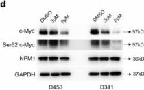 c-Myc (E5Q6W) Rabbit mAb | Cell Signaling Technology