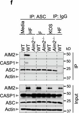 Fig.2.F showing Western Blotting in a Mus musculus (House mouse) sample from the publication: Herpes simplex virus 1 harboring poly(T) DNA sequences as a key ligand for AIM2 inflammasome activation and host defense.