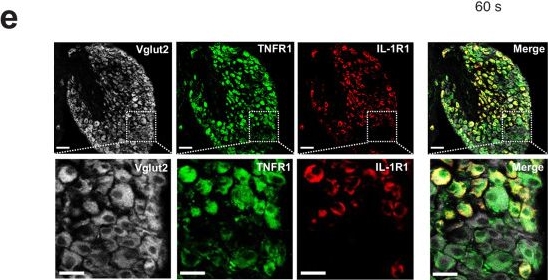 Fig.2.E showing Immunohistochemistry-immunofluorescence in a Mus musculus (House mouse) sample from the publication: Neural representation of cytokines by vagal sensory neurons.