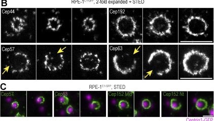 Fig.5.B showing Immunocytochemistry-immunofluorescence in a Homo sapiens (Human) sample from the publication: Centrosomal organization of Cep152 provides flexibility in Plk4 and procentriole positioning.
