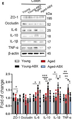 Fig.6.E showing Western Blotting from the publication: Aged gut microbiota promotes arrhythmia susceptibility via oxidative stress.
