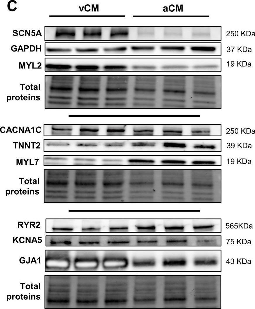 Fig.1.C showing Western Blotting in a Homo sapiens (Human) sample from the publication: Biophysical properties of NaV1.5 channels from atrial-like and ventricular-like cardiomyocytes derived from human induced pluripotent stem cells.