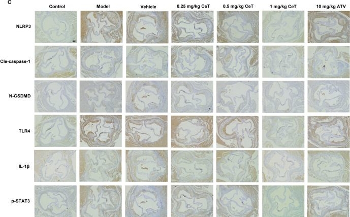 Fig.6.C showing Immunohistochemistry from the publication: Celastrol ameliorates atherosclerosis by inhibiting TLR4/STAT3/NLRP3-mediated macrophage pyroptosis.