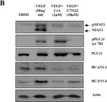Fig.4.B showing Western Blotting from the publication: Kaposi's sarcoma herpesvirus K15 protein contributes to virus-induced angiogenesis by recruiting PLCγ1 and activating NFAT1-dependent RCAN1 expression.