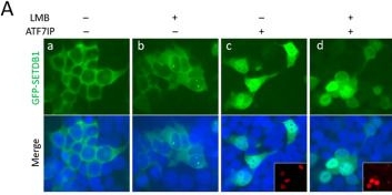 Fig.2.A showing Immunocytochemistry-immunofluorescence in a Homo sapiens (Human) sample from the publication: Functional dissection of N-terminal nuclear trafficking signals of SETDB1.