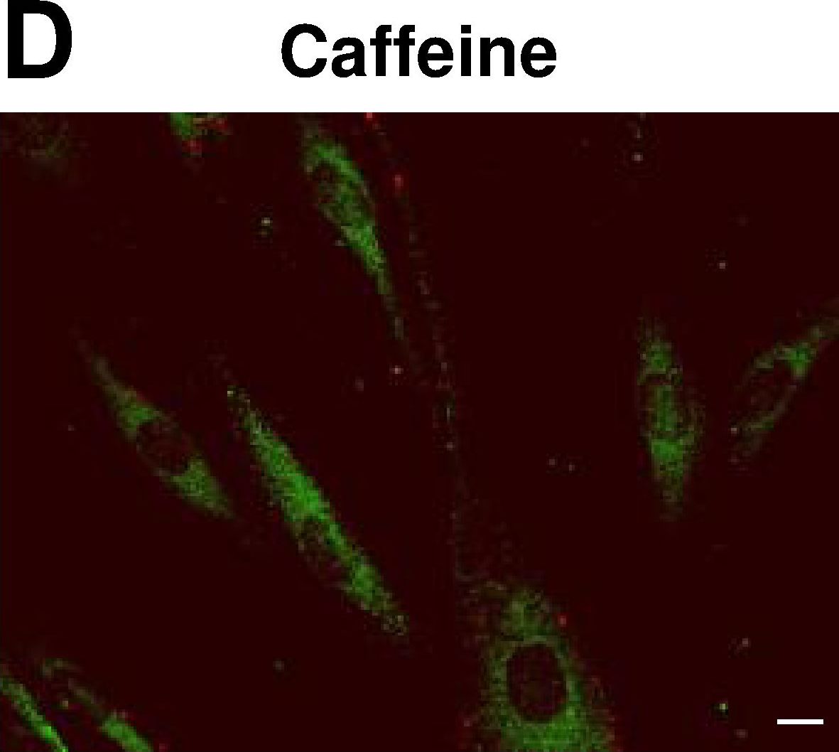 Cellular localization and associations of the major lipolytic proteins in human skeletal muscle at rest and during exercise.